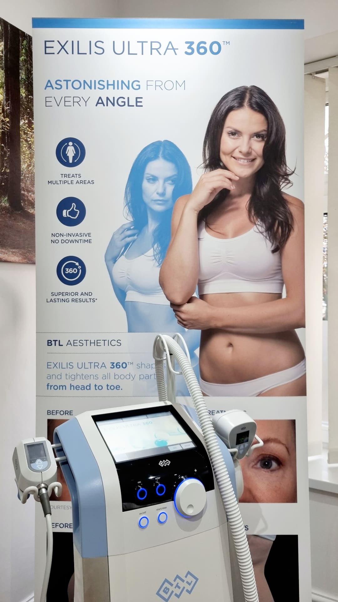Exilis Ultra 360 equipment